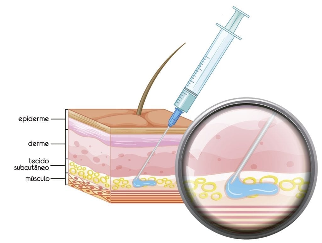 TECIDO SUBCUTANEO ILUSTRATIVA